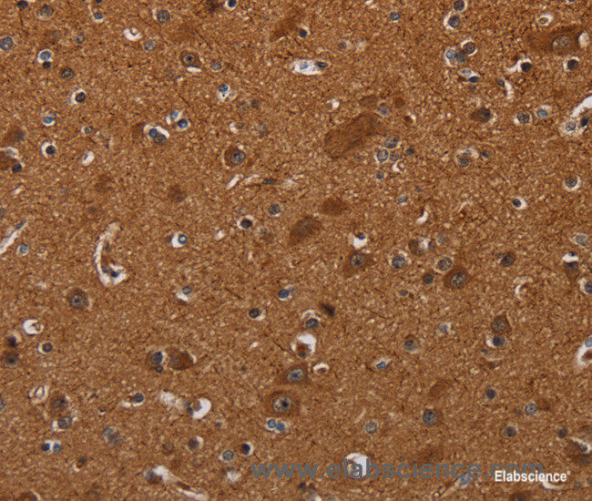 Immunohistochemistry of paraffin-embedded Human brain tissue using CYBB Polyclonal Antibody at dilution 1:40
