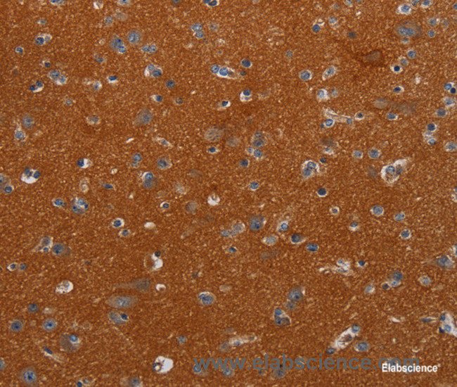 Immunohistochemistry of paraffin-embedded Human brain tissue using NOX3 Polyclonal Antibody at dilution 1:40