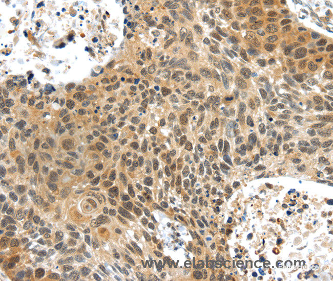 Immunohistochemistry of paraffin-embedded Human brain tissue using PLIN3 Polyclonal Antibody at dilution 1:40