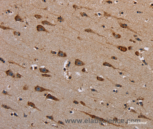Immunohistochemistry of paraffin-embedded Human brain tissue using PLXNB1 Polyclonal Antibody at dilution 1:40