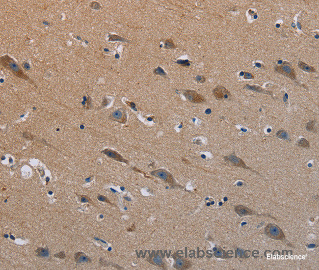 Immunohistochemistry of paraffin-embedded Human brain tissue using PLXND1 Polyclonal Antibody at dilution 1:40