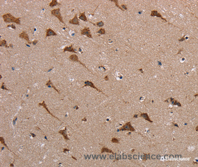 Immunohistochemistry of paraffin-embedded Human brain tissue using POMT1 Polyclonal Antibody at dilution 1:40