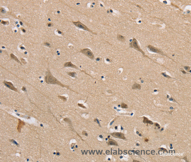Immunohistochemistry of paraffin-embedded Human brain tissue using DLG2 Polyclonal Antibody at dilution 1:40