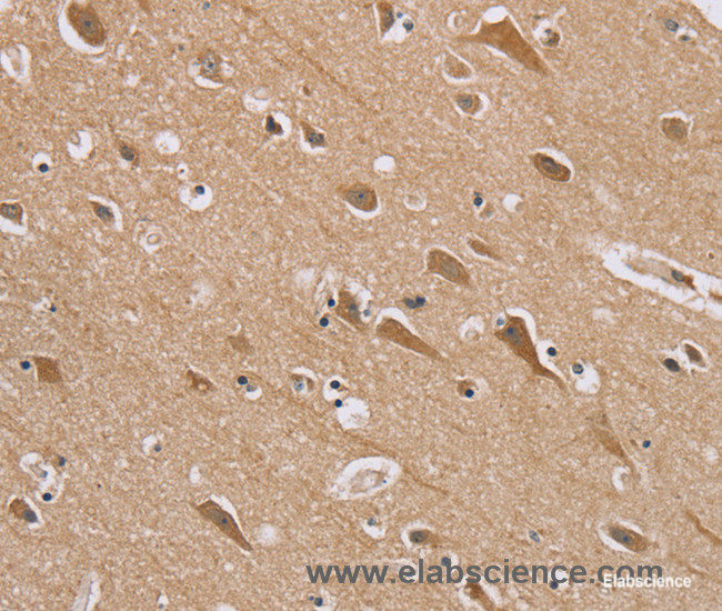 Immunohistochemistry of paraffin-embedded Human brain tissue using RAB6C Polyclonal Antibody at dilution 1:45