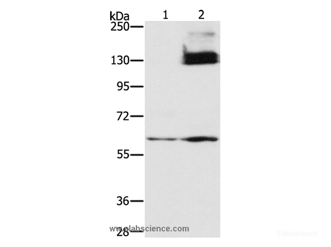 Western Blot analysis of Untreated and treated with cobalt chloride (0.1 mM for 4 hours) of hela cell using HIF1 alpha Polyclonal Antibody at dilution of 1:400