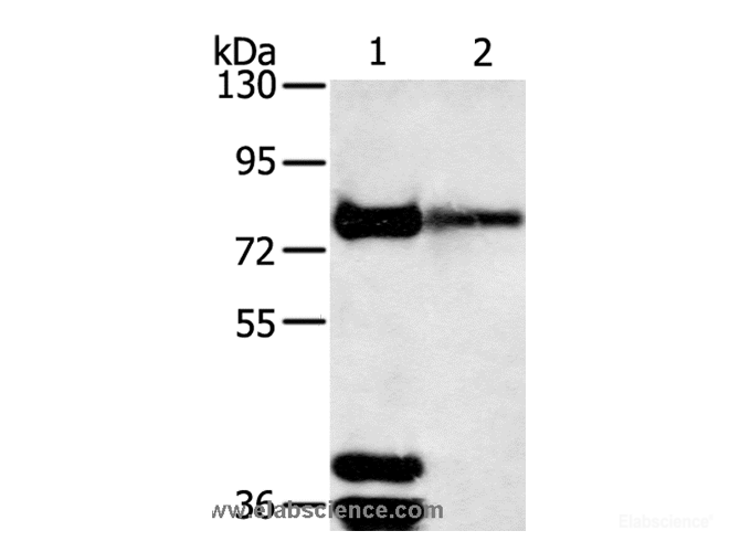 Western Blot analysis of Mouse brain and Human fetal brain tissue using TRIM3 Polyclonal Antibody at dilution of 1:200