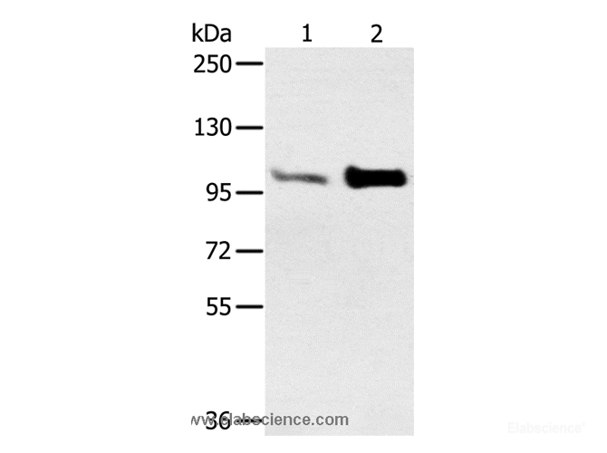 Western Blot analysis of Mouse muscle and heart tissue using ACTN2 Polyclonal Antibody at dilution of 1:300