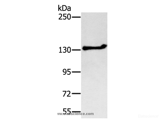 Western Blot analysis of Jurkat cell using NEMF Polyclonal Antibody at dilution of 1:200