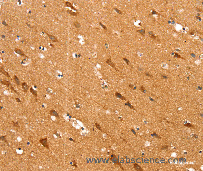 Immunohistochemistry of paraffin-embedded Human brain tissue using SLC25A12 Polyclonal Antibody at dilution 1:30