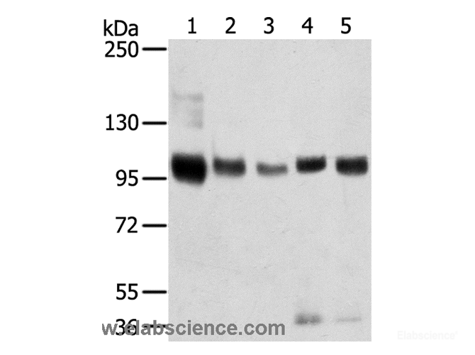 Western Blot analysis of Mouse brain and Human brain tissue, Human prostate tissue, Human fat and placenta tissue using SORT1 Polyclonal Antibody at dilution of 1:200
