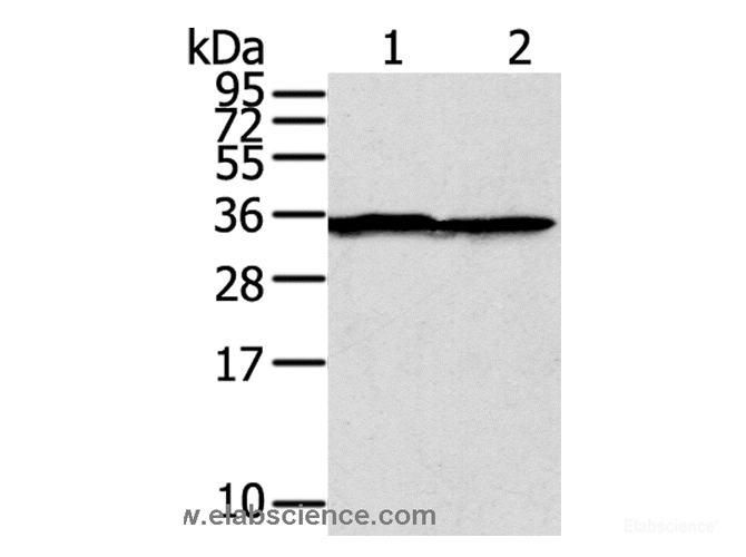 Western Blot analysis of A375 cell using STX3 Polyclonal Antibody at dilution of 1:400
