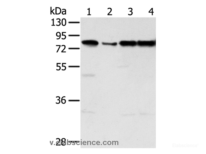Western Blot analysis of Jurkat, hepg2, Raji and A431 cell using TAF15 Polyclonal Antibody at dilution of 1:450