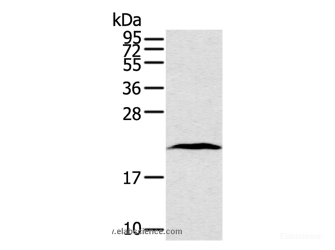 Western Blot analysis of Human lung cancer tissue using TAF10 Polyclonal Antibody at dilution of 1:400
