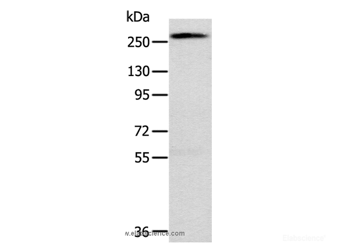 Western Blot analysis of Huvec cell using TLN1 Polyclonal Antibody at dilution of 1:200