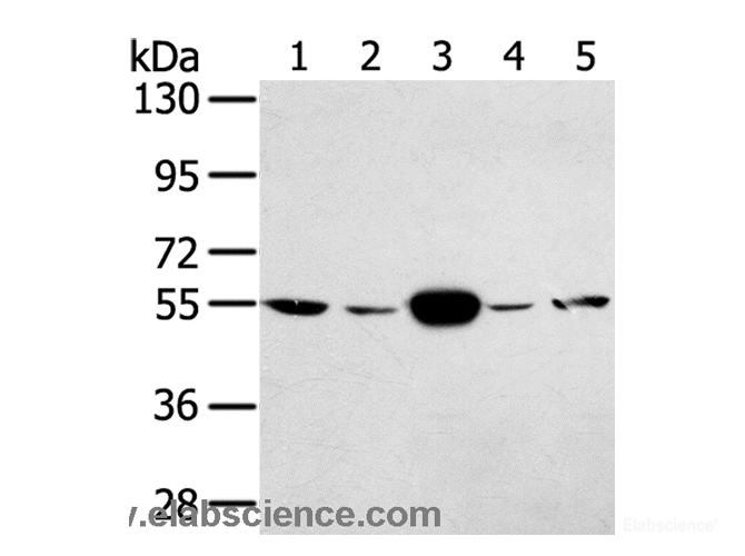 Western Blot analysis of Hela and K562 cell, Human fetal muscle tissue, A375 and hepg2 cell using TRIM35 Polyclonal Antibody at dilution of 1:400