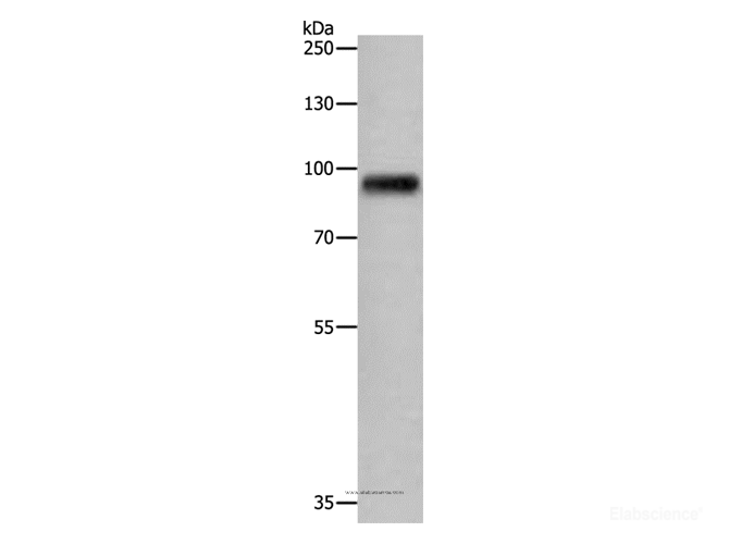 Western Blot analysis of Human fetal brain tissue using APLP1 Polyclonal Antibody at dilution of 1:650