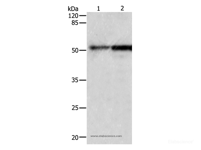 Western Blot analysis of Human fetal kidney and lung tissue using CASP2 Polyclonal Antibody at dilution of 1:950