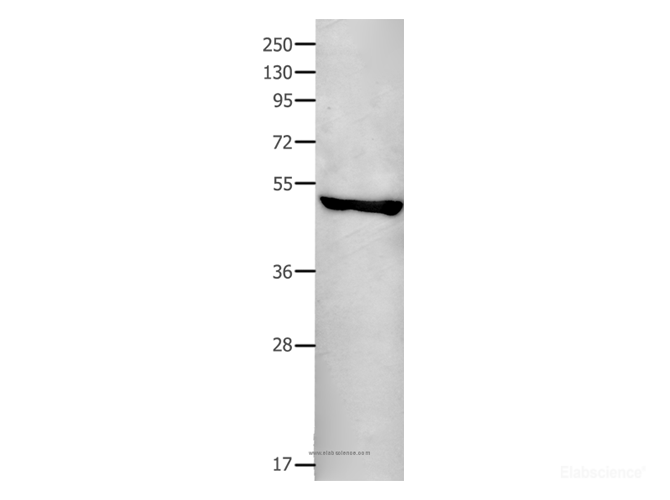 Western Blot analysis of Human fetal brain tissue using FAS Polyclonal Antibody at dilution of 1:550