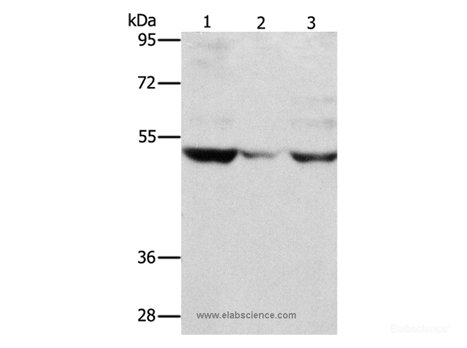 Western Blot analysis of PC3 cell and Mouse muscle tissue, A375 cell using MMP1 Polyclonal Antibody at dilution of 1:500
