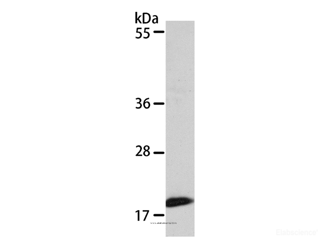 Western Blot analysis of 293T cell using EIF4EBP1 Polyclonal Antibody at dilution of 1:320