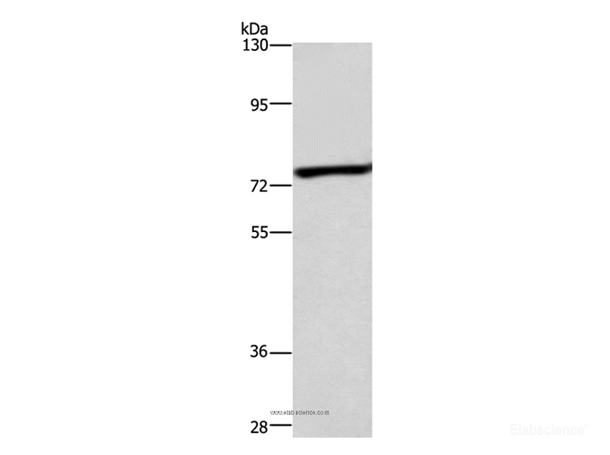 Western Blot analysis of Mouse heart tissue using ABCB8 Polyclonal Antibody at dilution of 1:600