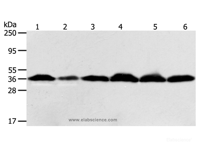 Western Blot analysis of Hela cell and Human liver cancer tissue, Raji, Jurkat, 293T and PC3 cell using APEX1 Polyclonal Antibody at dilution of 1:450