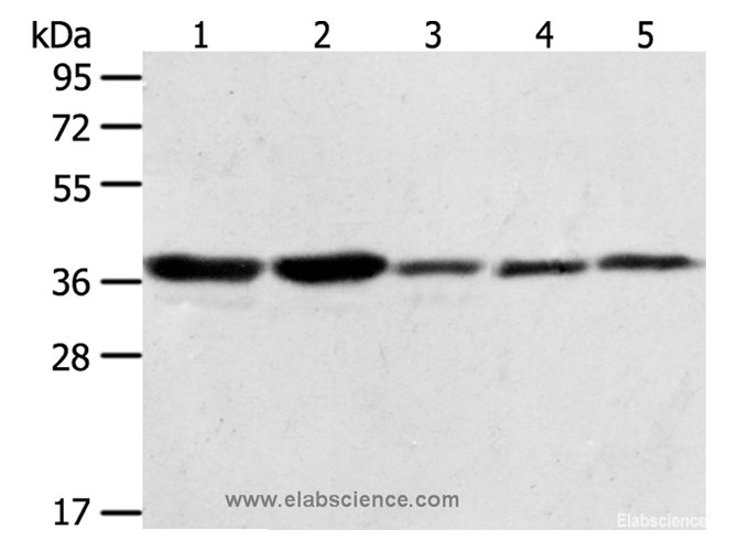 Western Blot analysis of A431, NIH/3T3, Hela, Jurkat and PC3 cell using ANXA1 Polyclonal Antibody at dilution of 1:400