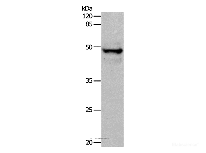 Western Blot analysis of Mouse thymus tissue using CK-15 Polyclonal Antibody at dilution of 1:400