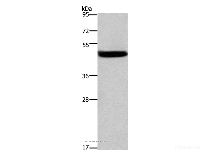 Western Blot analysis of Mouse stomach tissue using Cathepsin E Polyclonal Antibody at dilution of 1:525