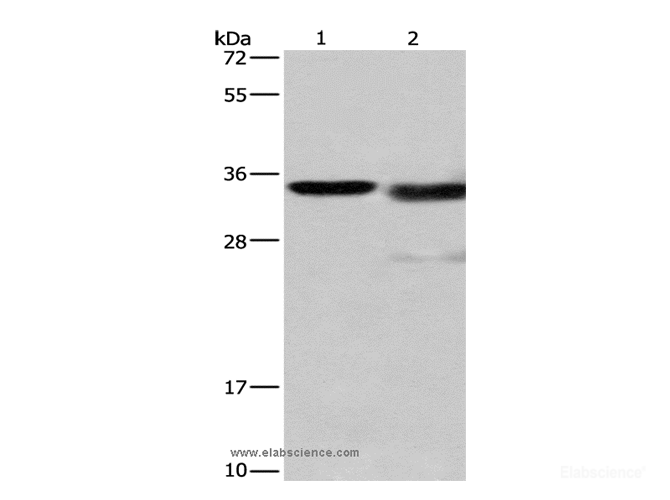 Western Blot analysis of Mouse kidney tissue and A172 cell using Cathepsin L Polyclonal Antibody at dilution of 1:900