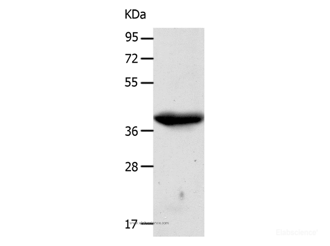 Western Blot analysis of A549 cell using CDK7 Polyclonal Antibody at dilution of 1:500