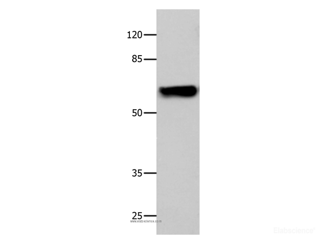 Western Blot analysis of 293T cell using CNGA2 Polyclonal Antibody at dilution of 1:500