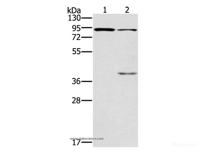 Western Blot analysis of Mouse kidney and brain tissue using CNGA3 Polyclonal Antibody at dilution of 1:500