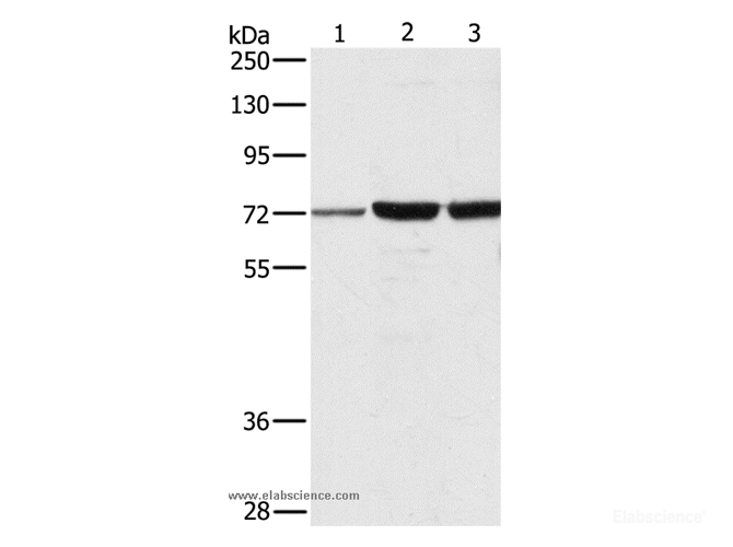 Western Blot analysis of A375, 231 and hela cell using DOK1 Polyclonal Antibody at dilution of 1:750