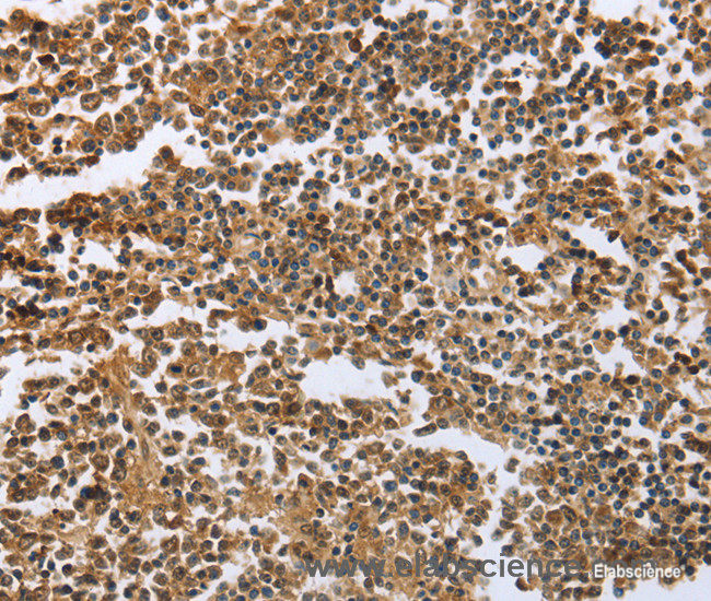 Immunohistochemistry of paraffin-embedded Human tonsil tissue using ECE1 Polyclonal Antibody at dilution 1:60
