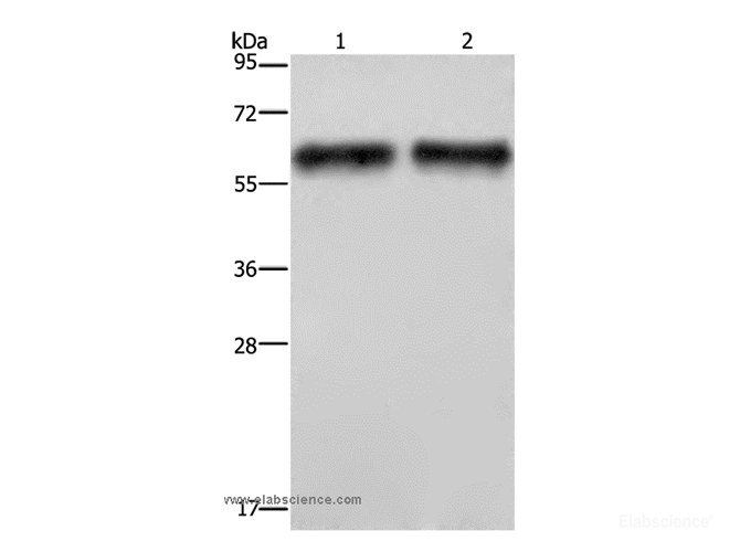 Western Blot analysis of Human hepatocellular carcinoma tissue using ELN Polyclonal Antibody at dilution of 1:400