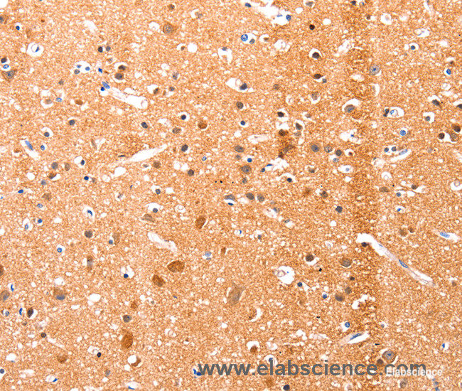 Immunohistochemistry of paraffin-embedded Human brain tissue using Ephrin A1 Polyclonal Antibody at dilution 1:51