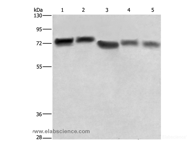 Western Blot analysis of Hela cell and Human brain tissue, 293T cell, Human hepatocellular carcinoma tissue and NIH/3T3 cell using RDX Polyclonal Antibody at dilution of 1:600