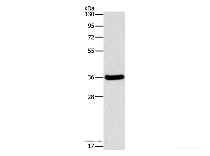 Western Blot analysis of Human fetal liver tissue using FGL1 Polyclonal Antibody at dilution of 1:1050
