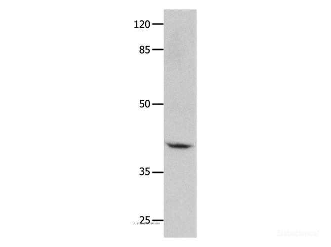 Western Blot analysis of Human leiomyosarcoma tissue using GNA11 Polyclonal Antibody at dilution of 1:450