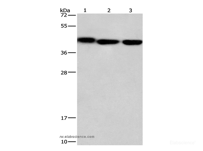 Western Blot analysis of Mouse kidney tissue, Human testis and brain malignant glioma tissue using GNA13 Polyclonal Antibody at dilution of 1:450