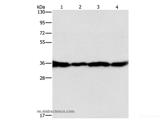 Western Blot analysis of HepG2, A549, 293T and 231 cell using GNB1 Polyclonal Antibody at dilution of 1:400
