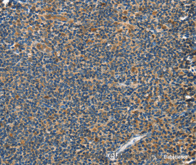 Immunohistochemistry of paraffin-embedded Human tonsil tissue using GRB7 Polyclonal Antibody at dilution 1:40