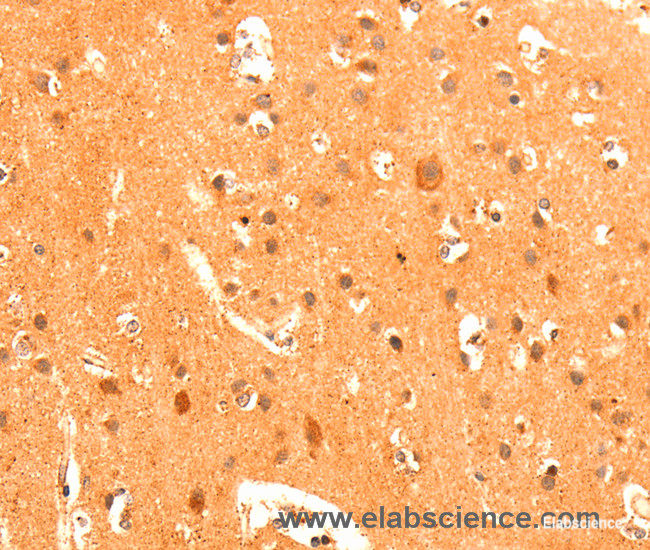 Immunohistochemistry of paraffin-embedded Human brain tissue using GRM3 Polyclonal Antibody at dilution 1:50
