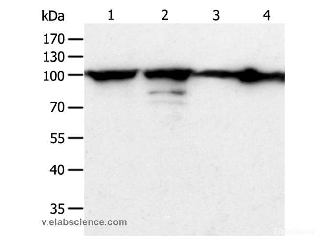 Western Blot analysis of Hela cell and Human liver cancer tissue, Jurkat and NIH/3T3 cell using HSP90B1 Polyclonal Antibody at dilution of 1:900