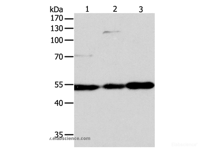 Western Blot analysis of Jurkat, Hela and A549 cell using GSR Polyclonal Antibody at dilution of 1:750