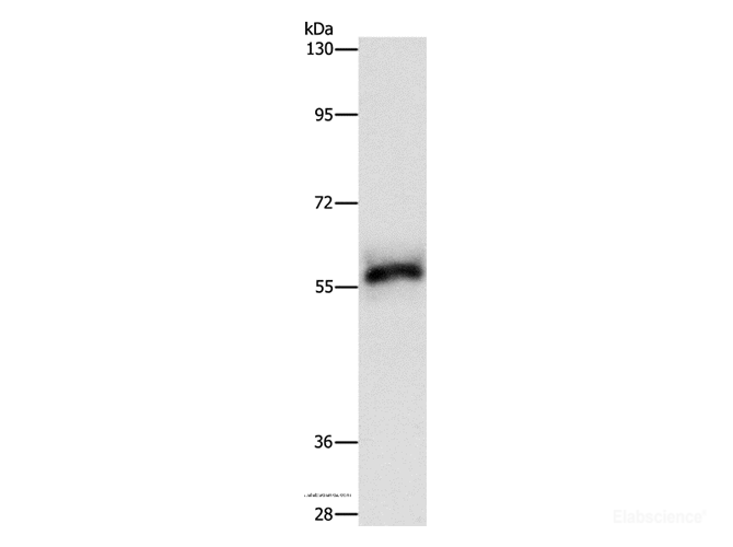 Western Blot analysis of Hela cell using HCK Polyclonal Antibody at dilution of 1:500