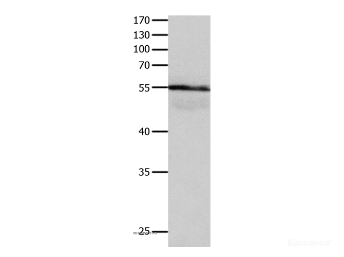 Western Blot analysis of Human brain gliomas tissue using HP Polyclonal Antibody at dilution of 1:400