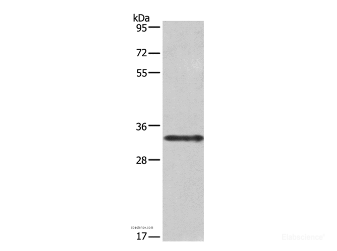 Western Blot analysis of Jurkat cell using IL1A Polyclonal Antibody at dilution of 1:666