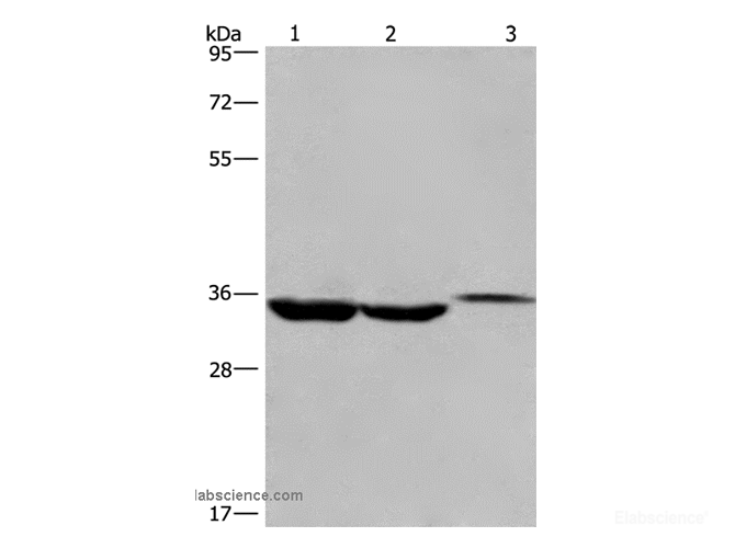 Western Blot analysis of Lovo cell,Human liver cancer tissue and Mouse kidney tissue using ING2 Polyclonal Antibody at dilution of 1:425